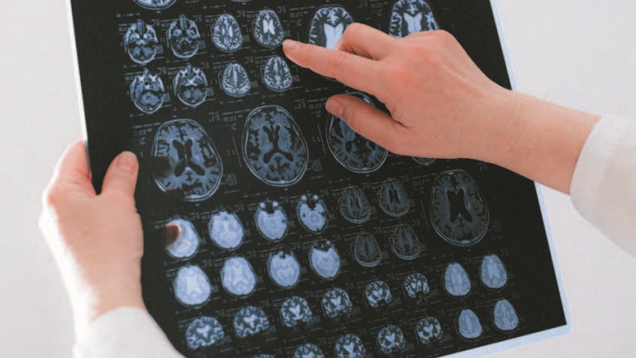 Învățarea și neuroplasticitatea în creierul adult